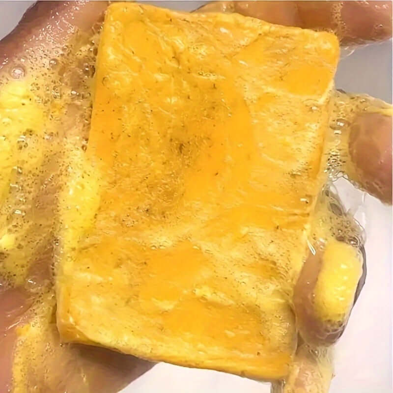 Turmeric Soap Bars – Brightening & Deep Cleansing handmade skincare essentials for glowing skin.