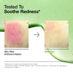 Korea ANUA Niacinamide and Tranexamic Serum results showing effectiveness for acne-prone skin and reduction in redness.