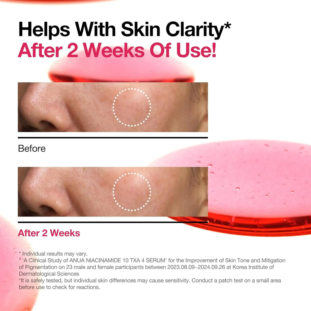 ANUA Dark Spot Correcting Serum with Niacinamide and TXA for radiant, balanced skin.