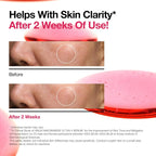 ANUA Dark Spot Correcting Serum with Niacinamide and TXA for radiant, balanced skin.