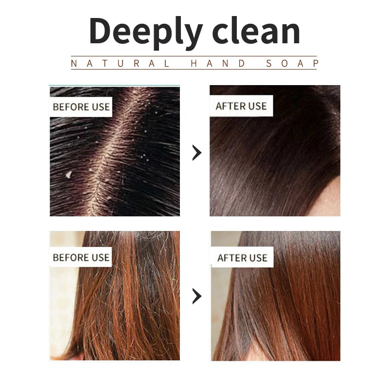 Lavender Shampoo – Oil Control & Refreshing Hair Care product  before and after use
