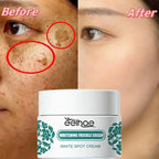 Visual demonstration of Niacinamide Brightening Cream results, showing before and after effects on dark spots and complexion. Visual demonstration of Niacinamide Brightening Cream results, showing before and after effects on dark spots and complexion.