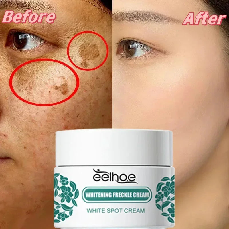 Visual demonstration of Niacinamide Brightening Cream results, showing before and after effects on dark spots and complexion. Visual demonstration of Niacinamide Brightening Cream results, showing before and after effects on dark spots and complexion.