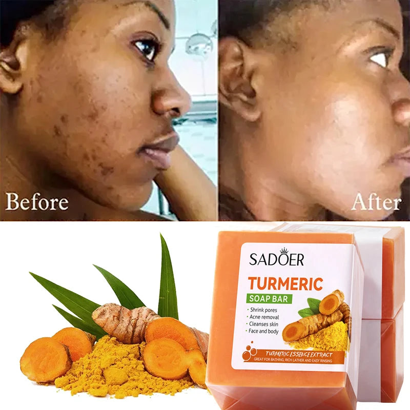 Radiant Skin Kojic Soap