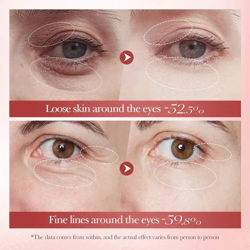 Anti-Wrinkle Eye Cream – Collagen & Dark Circle Care is effective against fine lines and dark circles.