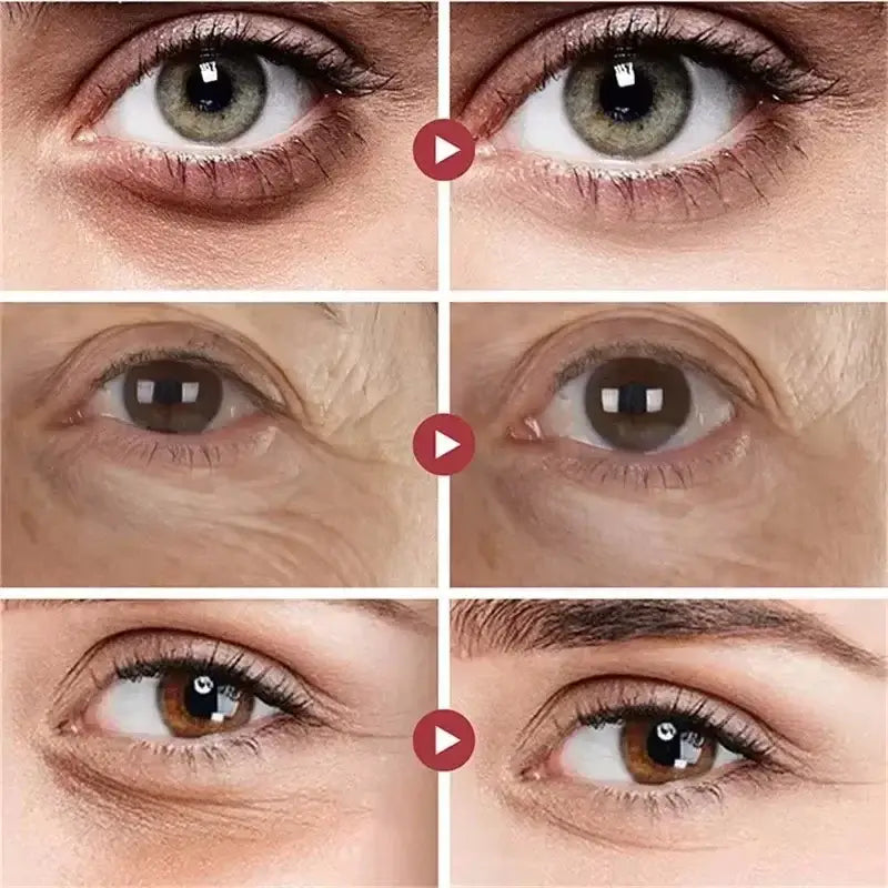 Anti-Wrinkle Eye Cream – Collagen & Dark Circle Care is effective against fine lines and dark circles.