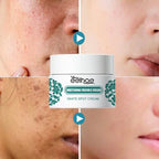 Visual demonstration of Niacinamide Brightening Cream results, showing before and after effects on dark spots and complexion. Visual demonstration of Niacinamide Brightening Cream results, showing before and after effects on dark spots and complexion.