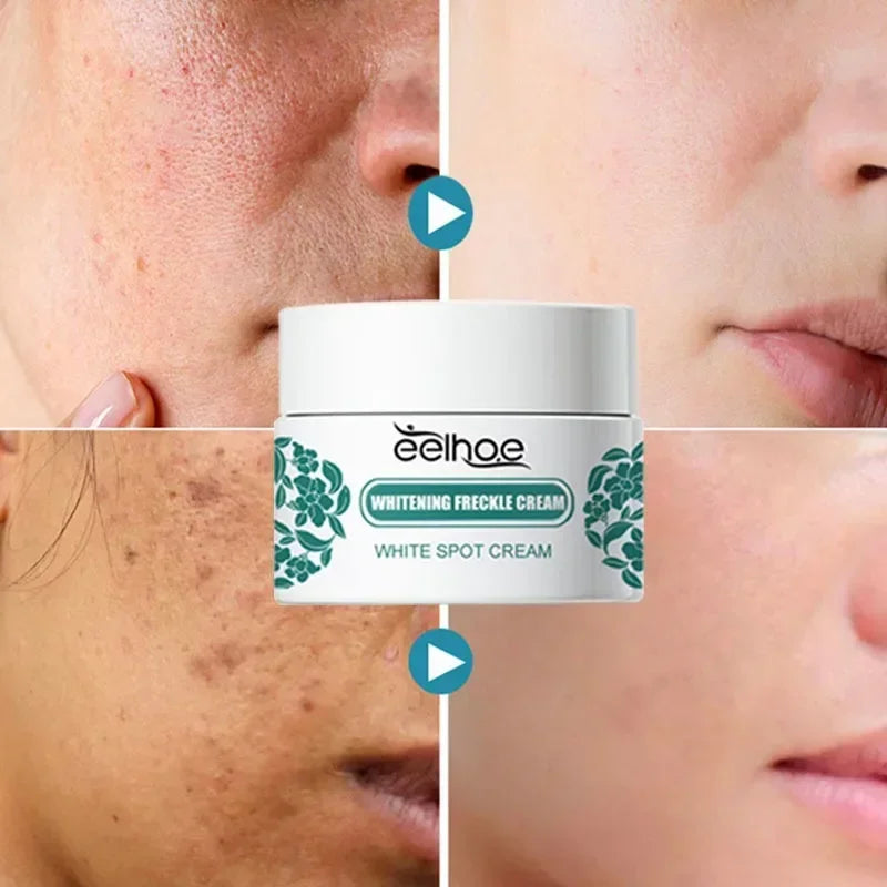 Visual demonstration of Niacinamide Brightening Cream results, showing before and after effects on dark spots and complexion. Visual demonstration of Niacinamide Brightening Cream results, showing before and after effects on dark spots and complexion.