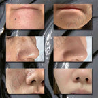 Before and after results showing skin texture improvement using Dead Sea Mud Face Mask Deep Cleaning Pores Remove Blackheads Oil Control Moisturizing Brighten Smooth Skin Care Beauty Products.