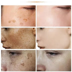 Visual demonstration of Niacinamide Brightening Cream results, showing before and after effects on dark spots and complexion. Visual demonstration of Niacinamide Brightening Cream results, showing before and after effects on dark spots and complexion.