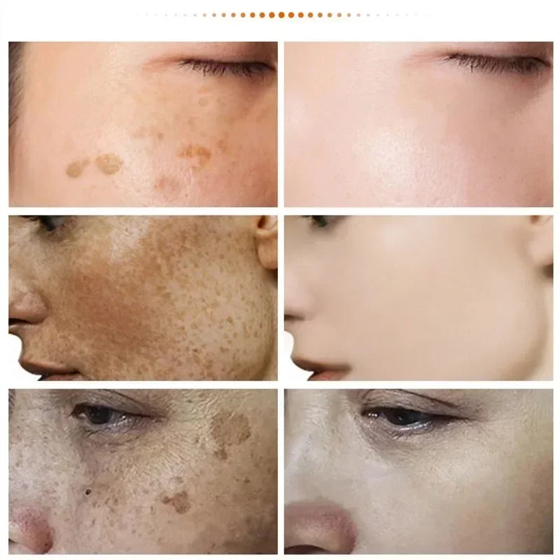 Visual demonstration of Niacinamide Brightening Cream results, showing before and after effects on dark spots and complexion. Visual demonstration of Niacinamide Brightening Cream results, showing before and after effects on dark spots and complexion.