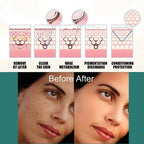 Visual demonstration of Niacinamide Brightening Cream results, showing before and after effects on dark spots and complexion.
