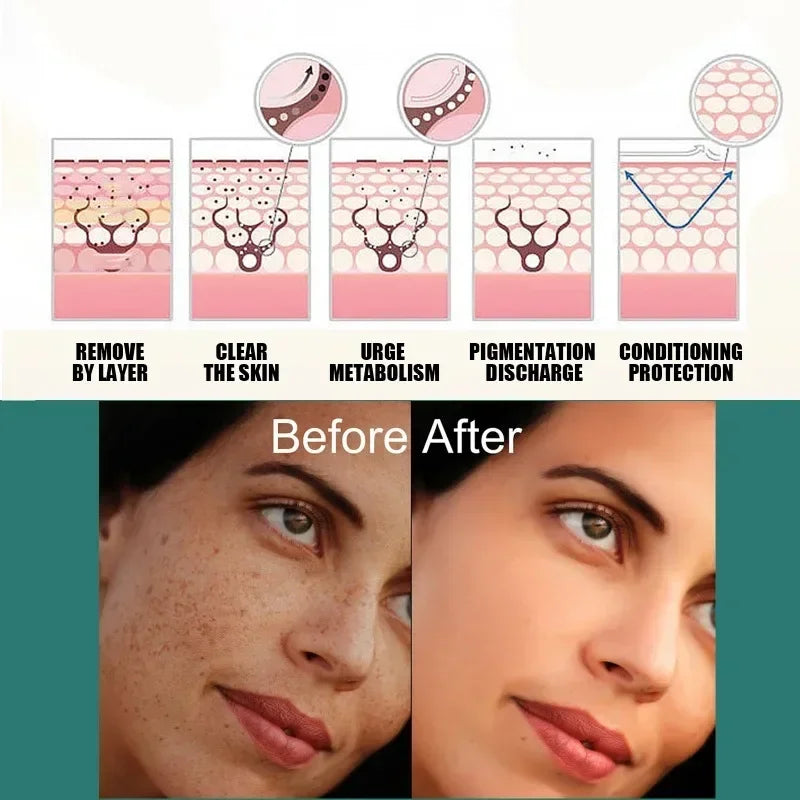 Visual demonstration of Niacinamide Brightening Cream results, showing before and after effects on dark spots and complexion.