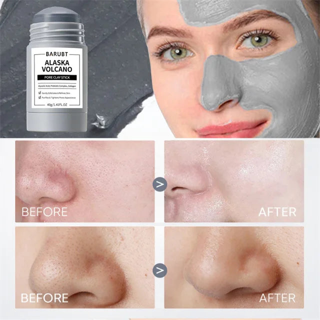 Before and after results showing skin texture improvement using Dead Sea Mud Face Mask Deep Cleaning Pores Remove Blackheads Oil Control Moisturizing Brighten Smooth Skin Care Beauty Products.