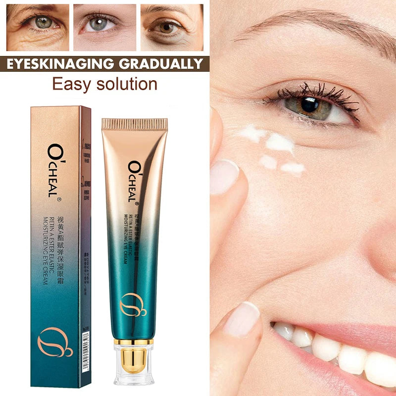 O’CHEAL Eye Moisturizing Cream for dark circles and puffiness, featuring application on under-eye skin.