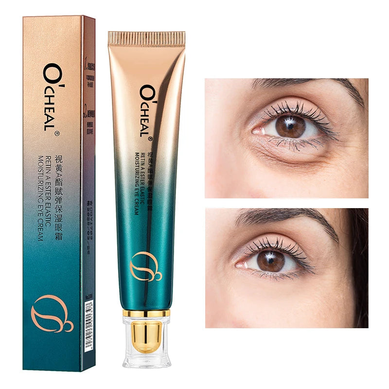 O’CHEAL Eye Moisturizing Cream for dark circles and puffiness, featuring application on under-eye skin.