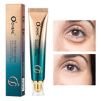 O’CHEAL Eye Moisturizing Cream for dark circles and puffiness, featuring application on under-eye skin.