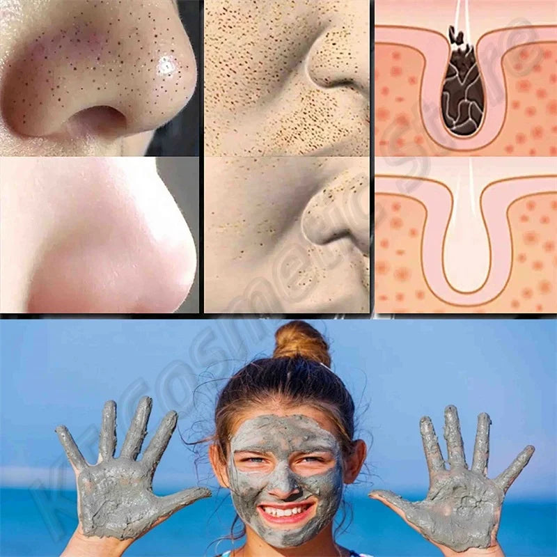 Before and after results showing skin texture improvement using Dead Sea Mud Face Mask Deep Cleaning Pores Remove Blackheads Oil Control Moisturizing Brighten Smooth Skin Care Beauty Products.